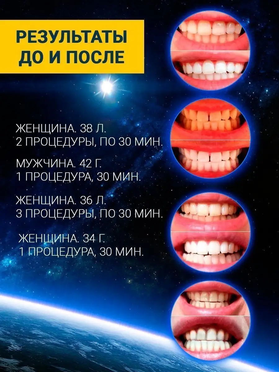 Отбеливатель для зубов Dent 3D White Отзывы, добавить отзыв
